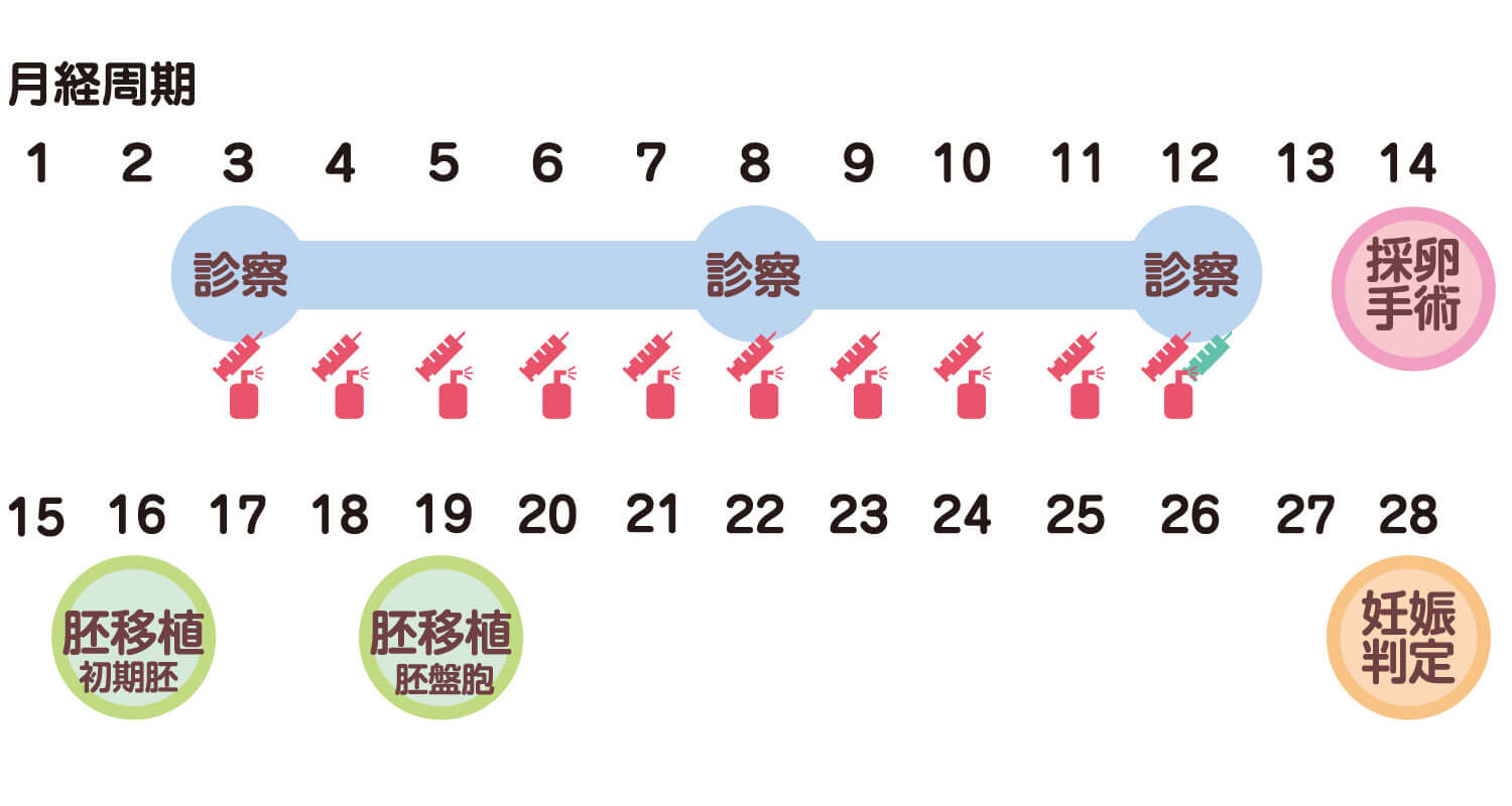 ショート法体外受精